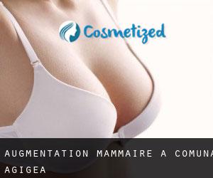 Augmentation mammaire à Comuna Agigea