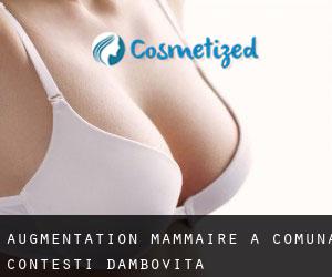 Augmentation mammaire à Comuna Conţeşti (Dâmboviţa)