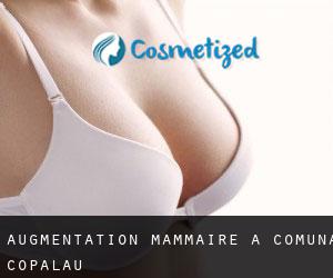 Augmentation mammaire à Comuna Copălău