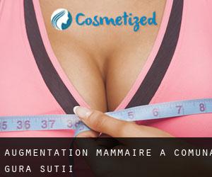 Augmentation mammaire à Comuna Gura Şuţii