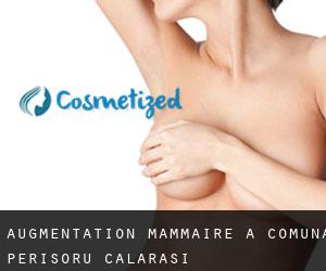 Augmentation mammaire à Comuna Perişoru (Călăraşi)