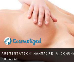 Augmentation mammaire à Comuna Suharău