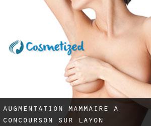 Augmentation mammaire à Concourson-sur-Layon