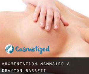 Augmentation mammaire à Drayton Bassett