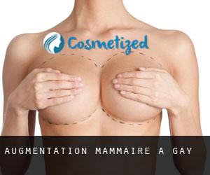 Augmentation mammaire à Gay