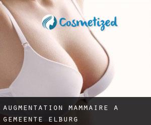 Augmentation mammaire à Gemeente Elburg