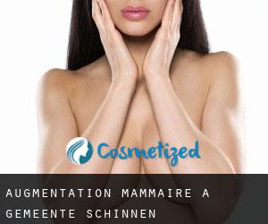 Augmentation mammaire à Gemeente Schinnen
