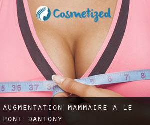 Augmentation mammaire à Le Pont-d'Antony