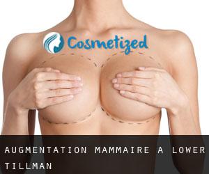 Augmentation mammaire à Lower Tillman