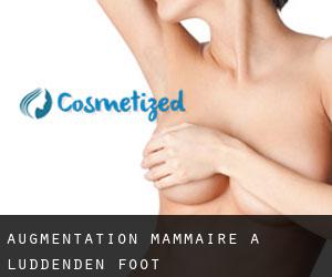 Augmentation mammaire à Luddenden Foot