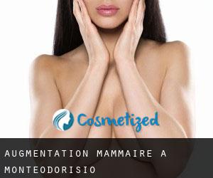Augmentation mammaire à Monteodorisio