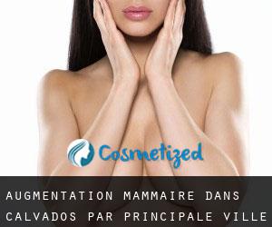 Augmentation mammaire dans Calvados par principale ville - page 20