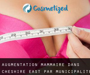 Augmentation mammaire dans Cheshire East par municipalité - page 1