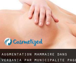 Augmentation mammaire dans Verbania par municipalité - page 1
