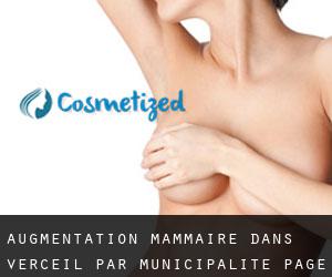 Augmentation mammaire dans Verceil par municipalité - page 1