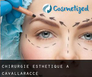 Chirurgie Esthétique à Cavallaracce