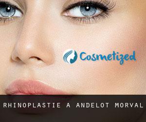 Rhinoplastie à Andelot-Morval