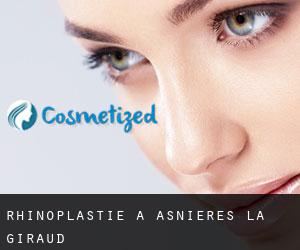 Rhinoplastie à Asnières-la-Giraud