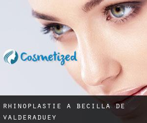 Rhinoplastie à Becilla de Valderaduey