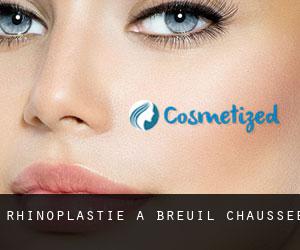 Rhinoplastie à Breuil-Chaussée