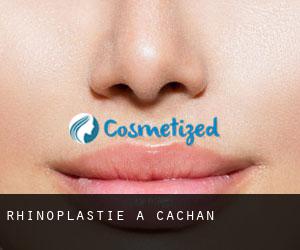 Rhinoplastie à Cachan