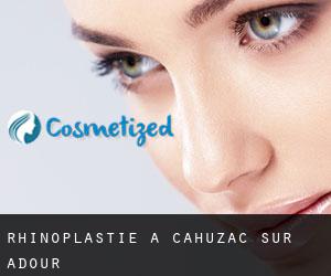 Rhinoplastie à Cahuzac-sur-Adour