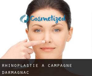 Rhinoplastie à Campagne-d'Armagnac