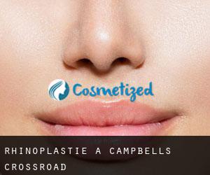 Rhinoplastie à Campbells Crossroad