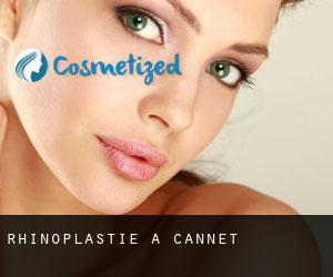 Rhinoplastie à Cannet