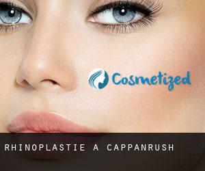 Rhinoplastie à Cappanrush