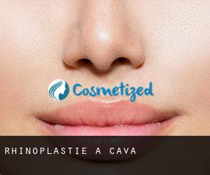 Rhinoplastie à Cava