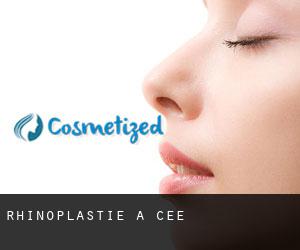 Rhinoplastie à Cee