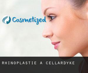 Rhinoplastie à Cellardyke