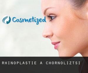 Rhinoplastie à Chornoliztsi