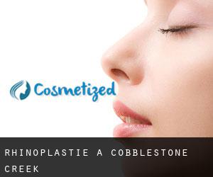 Rhinoplastie à Cobblestone Creek