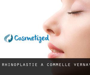 Rhinoplastie à Commelle-Vernay