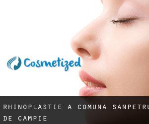 Rhinoplastie à Comuna Sânpetru de Câmpie