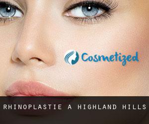 Rhinoplastie à Highland Hills