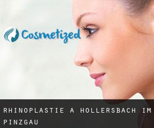 Rhinoplastie à Hollersbach im Pinzgau