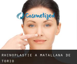 Rhinoplastie à Matallana de Torío