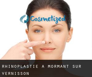 Rhinoplastie à Mormant-sur-Vernisson