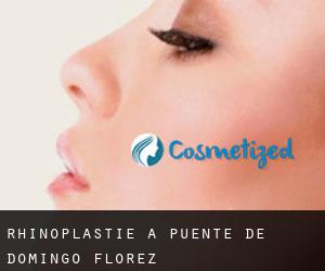 Rhinoplastie à Puente de Domingo Flórez