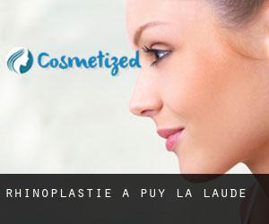 Rhinoplastie à Puy-la-Laude