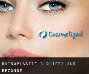 Rhinoplastie à Quiers-sur-Bézonde