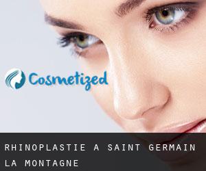 Rhinoplastie à Saint-Germain-la-Montagne