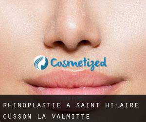 Rhinoplastie à Saint-Hilaire-Cusson-la-Valmitte