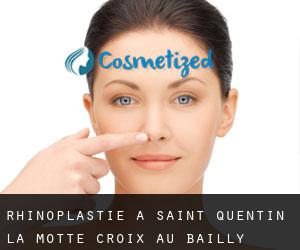 Rhinoplastie à Saint-Quentin-la-Motte-Croix-au-Bailly