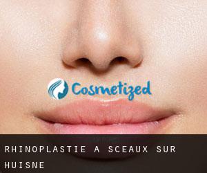 Rhinoplastie à Sceaux-sur-Huisne