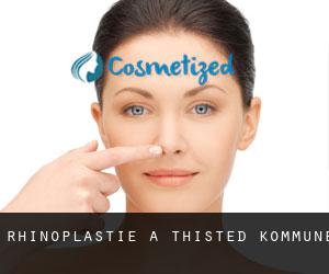 Rhinoplastie à Thisted Kommune