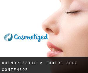 Rhinoplastie à Thoiré-sous-Contensor